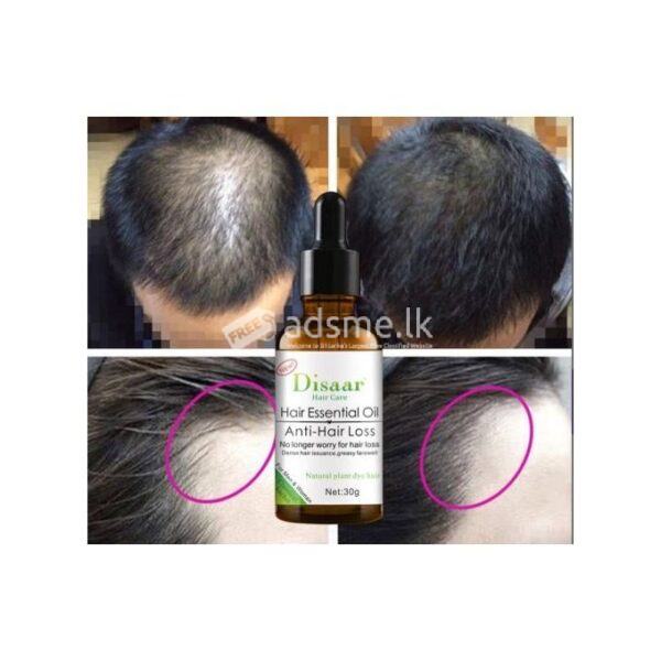 Disaar Hair Care Essential Oil Anti-Hair Loss No Longer Worry For Hair Loss 30g