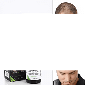 Disaar Hair Care Essential Oil Anti-Hair Loss No Longer Worry For Hair Loss 30g