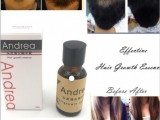 andrea hair growth